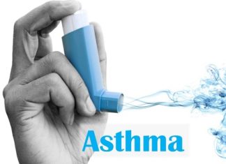 Asthma