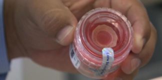 Donated cornea safe for 11 days: research